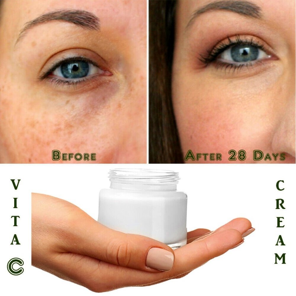 Matrixyl 3000 Peptide Hyaluronic Acid Retinol Collagen AntiAging Vitamin C Cream